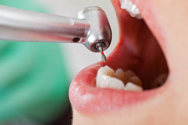 Best Root Canal Emergency Dentist  in Hybla Lley, VA